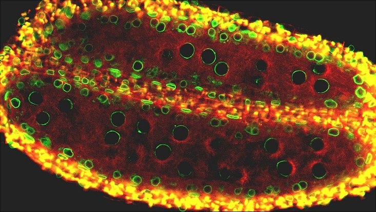 Progression of meiosis in anthers of Arabidopsis